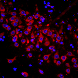 Identification of a divalent siRNA chemical scaffold for potent and sustained modulation of gene expression throughout the central nervous system.