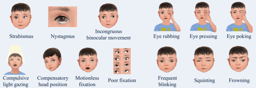 Deep learning based on dynamic behavioural phenotypes to evaluate the visual function of infants