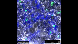 Dynamic passage of P. yoelli in the spleen