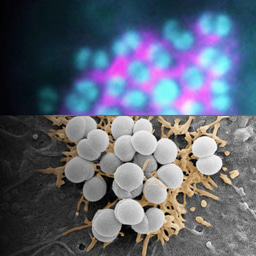 Meningococci exploit plasma membrane wetting to trap host receptors and initiate infection
