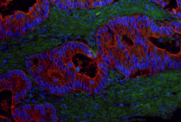 Establishing a link between G9a activity and pluripotency in colorectal cancer stem cells