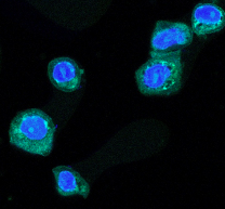 Exploring HCMV's emerging role as an oncovirus: induction of transformed ovarian epithelial cells by Human Cytomegalovirus (HCMV) 