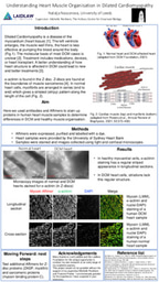 Research poster: Understanding Heart Muscle Organisation in Dilated Cardiomyopathy
