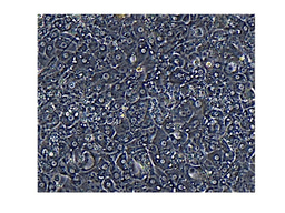 Modeling chronic hepatitis B virus infection in cell culture.