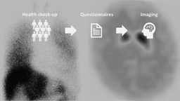 Clinico-imaging features of subjects at risk of Lewy body disease in NaT-PROBE baseline analysis
