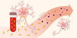 Plasma biomarkers of neurodegeneration in patients and high risk subjects with Lewy body disease