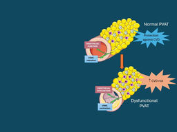 Obesity Day: Highlighting the Role of Perivascular Adipose Tissue in Vascular Health