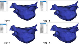 Unveiling the Impacts of Pulmonary Vein Isolation (PVI) Gaps by AF Digital Twin Technology