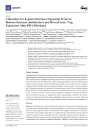 Colorectal Air–Liquid Interface Organoids Preserve Tumour-Immune Architecture and Reveal Local Treg Expansion After PD-1 Blockade