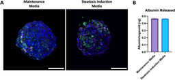 Engineering a three-dimensional liver steatosis model