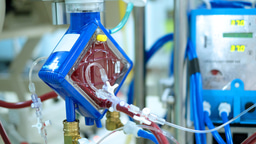 Call for papers: Extracorporeal membrane oxygenation (ECMO) Collection