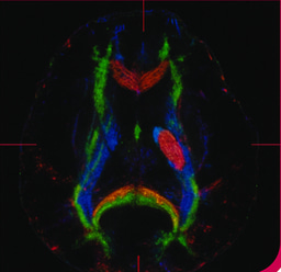 Introducing Translational Stroke Exchange
