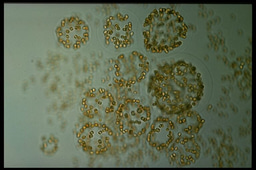 Ancient DNA Reveals Carbon Drawdown by Algal Blooms During the Antarctic Cold Reversal