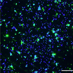 How MDA Phages Select Hyperadhesive Variants in Neisseria meningitidis?