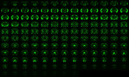 Discovery of a Unified Autism Circuit Signature via AI-Powered Whole-Brain Analysis