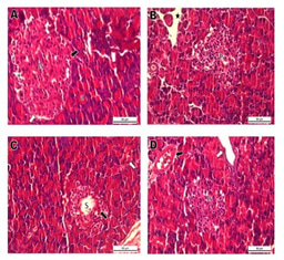 From Lab Hurdles to Hope: Pistacia vera L. Extract Tackles Oxidative Stress & Inflammation in Diabetic Rats