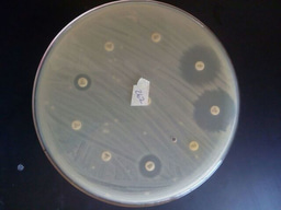 Beyond Contamination: How Antibiotic Resistant Bacteria are Spreading in Nigeria's Drinking Water