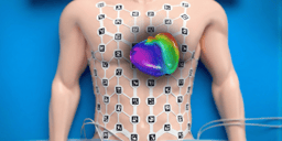 No More Blind Spots: Mapping the Entire Volume of the Human Heart