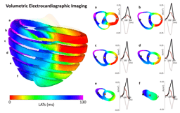 Mapping the Unmappable: How We Turned the Lights On Inside the Human Heart. By Jorge Vicente-Puig /Ismael Hernandez-Romero