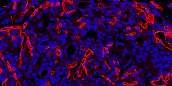 Peter Ratcliffe: "...I love discussing new data with lab members and planning new work."