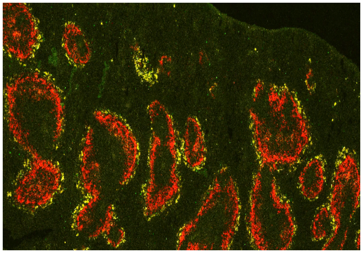 Pneumococcus Hiding from the Host