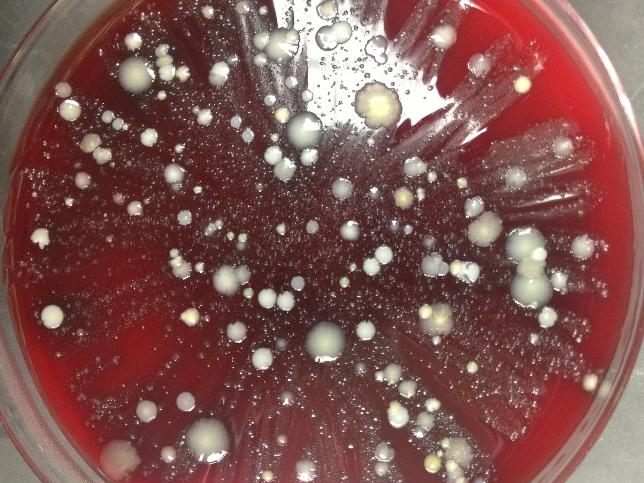 A Golden Opportunity: Eliminating Dogma about the Bladder’s Microbiome