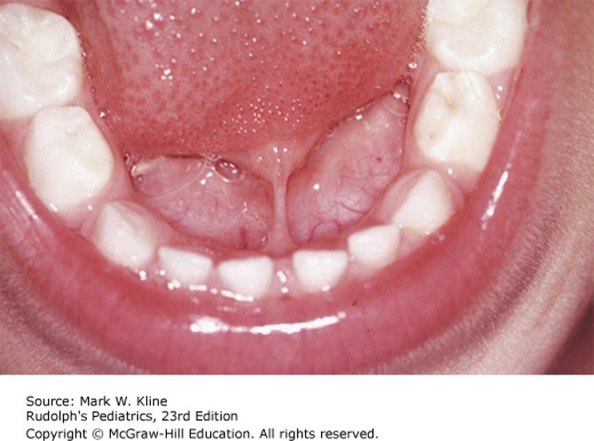 Ear, Nose and Throat Disorders Case