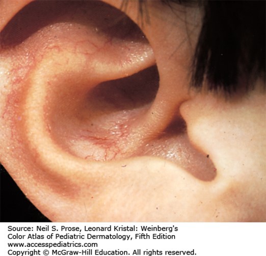 Allergic and Immunologic Disorders Case