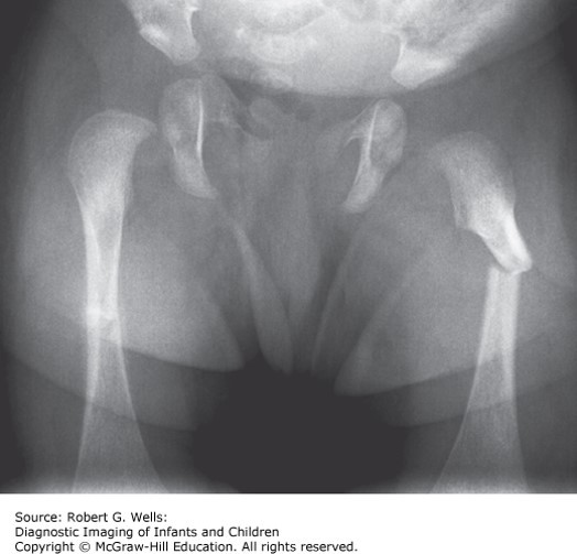 Musculoskeletal Disorders Case