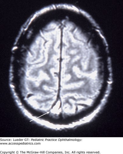 Neurologic Disorders Case