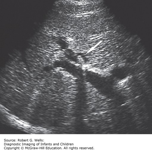 Pediatric Gastroenterology Case
