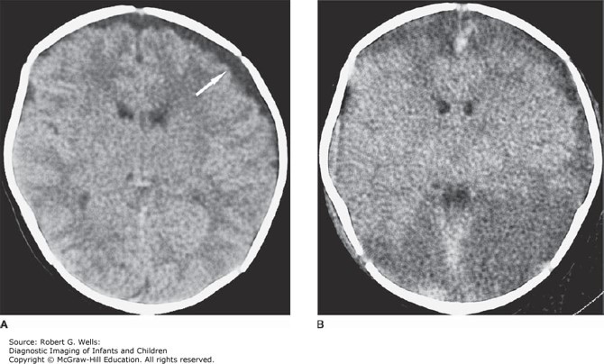 Neurologic Disorders Case