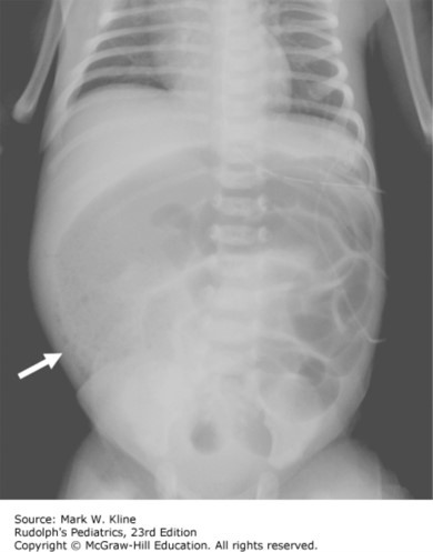 Fetus and Newborn Case 