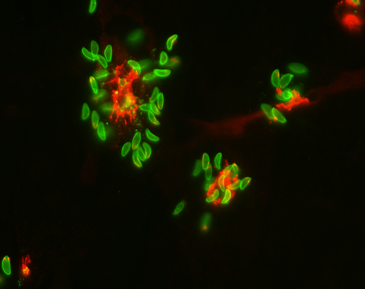 “Prison Break”: A programmed event controlled by a lipid mediator