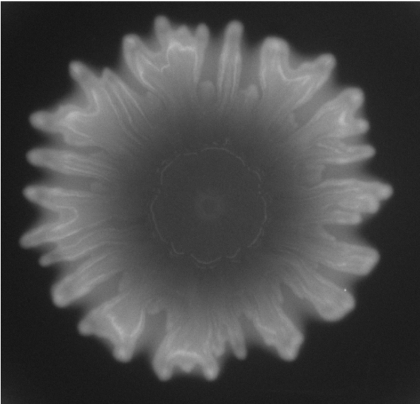 Understanding superbugs: from hospital to the lab