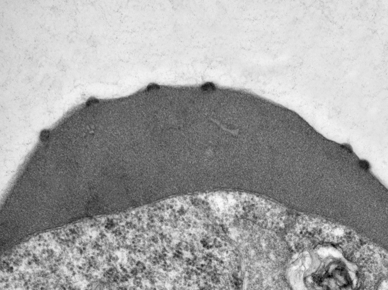 Malaria parasites teach an old channel a new trick