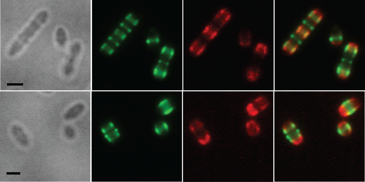 How the pneumococcus fights host immune attack as viewed in super resolution 