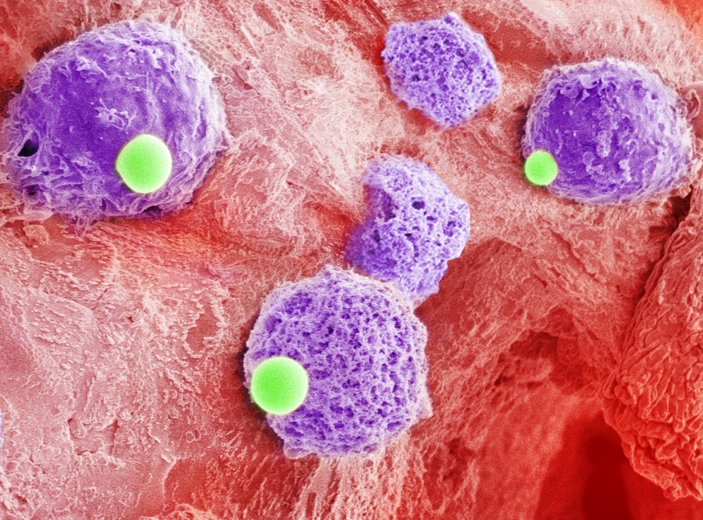 Cell assembly-mediated drug delivery for leukaemia immunotherapy