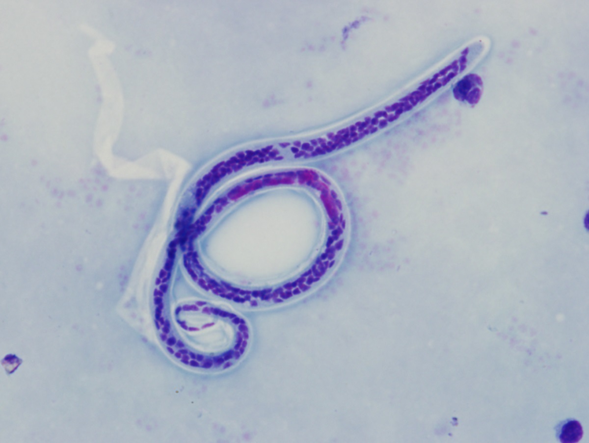 A New Method for Universal Parasite Detection by Targeted Deep Amplicon Sequencing 