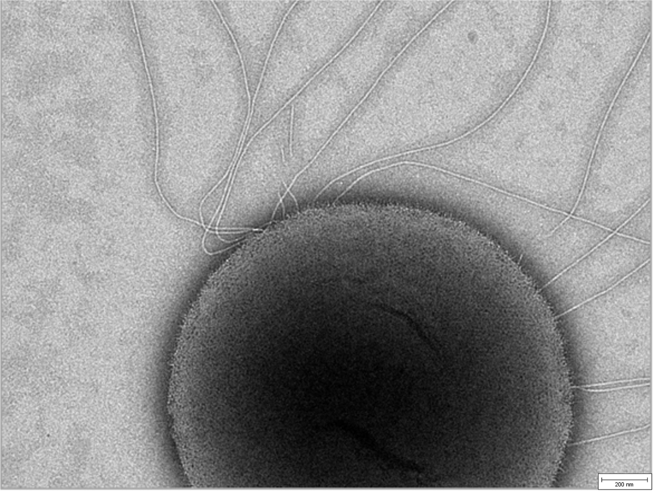 A hot new set of essential genes