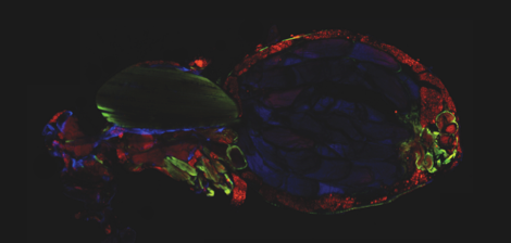 Intracellular parasitism in Drosophila: microsporidia go for the fat!