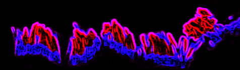 Influenza virus infection induces new cell populations in the lung