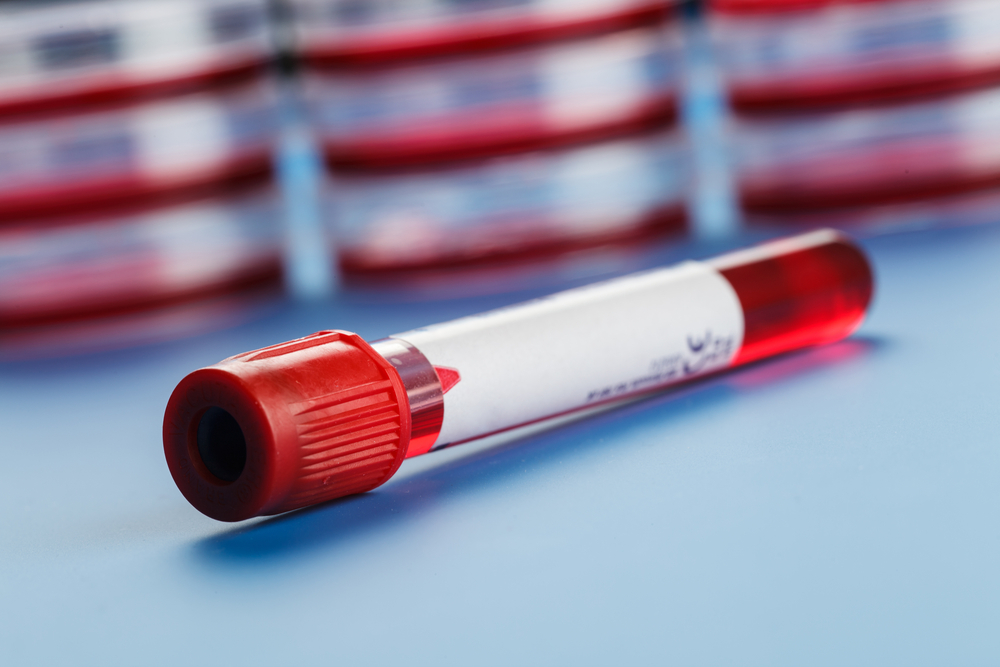 Could a routine blood test predict the development of diabetes? The