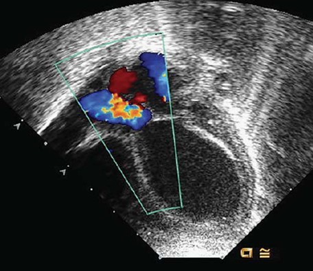 Populations of Oil and Gas Producing Regions Have High Rates of Congenital Heart Defects