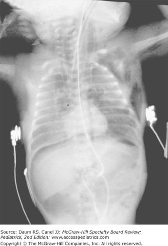 Neonatal Medicine Case