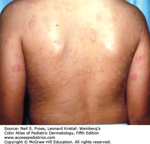 General Pediatrics Case