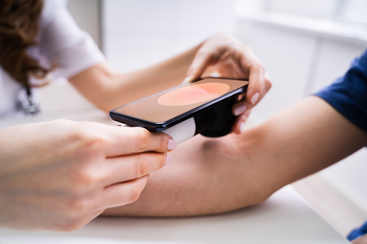 Smartphone apps to diagnose skin cancer how reliable? OnMedica