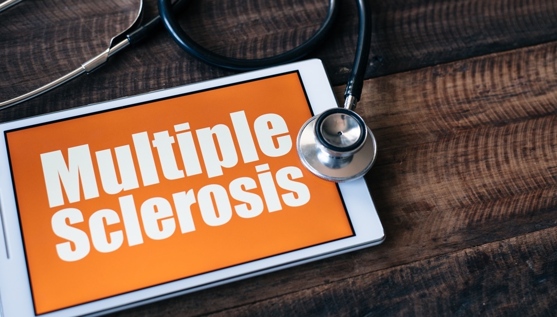 Siponimod in multiple sclerosis OnMedica