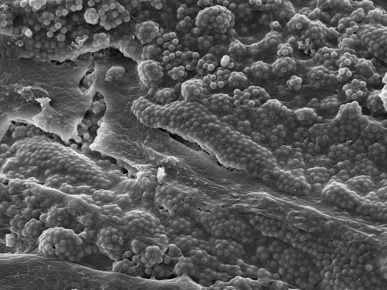 Birefringent nanoparticles that enhance vision in crustaceans