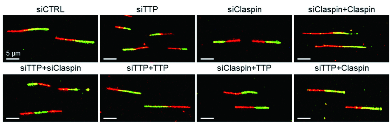 Posttranscriptional mechanism of replication stress response